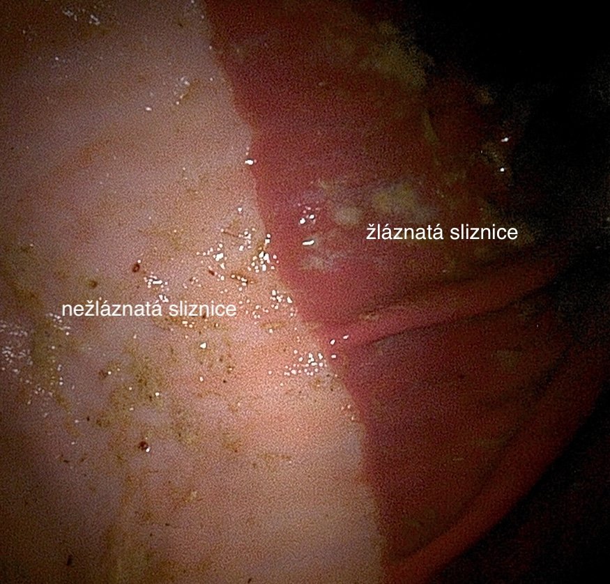 Rozdělení žláznaté a nežláznaté sliznice